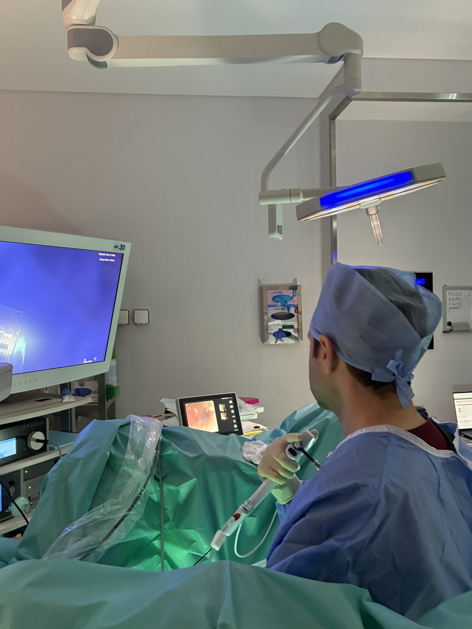 Dr Hadjipavlou performing ureteroscopic laser lithotripsy